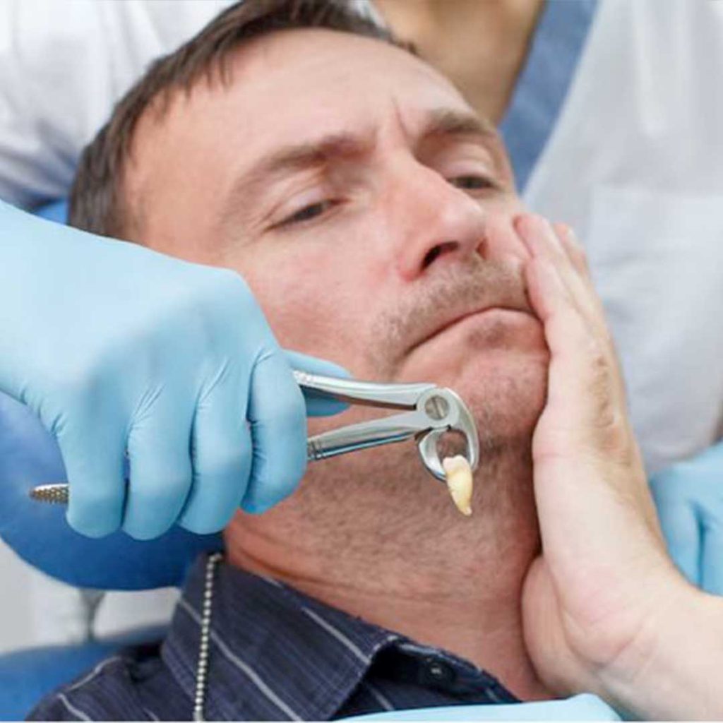 Board-certified oral surgeons using 3D CBCT imaging for safe and quick wisdom teeth removal in San Diego.