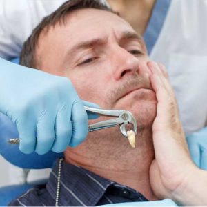 Board-certified oral surgeons using 3D CBCT imaging for safe and quick wisdom teeth removal in San Diego.