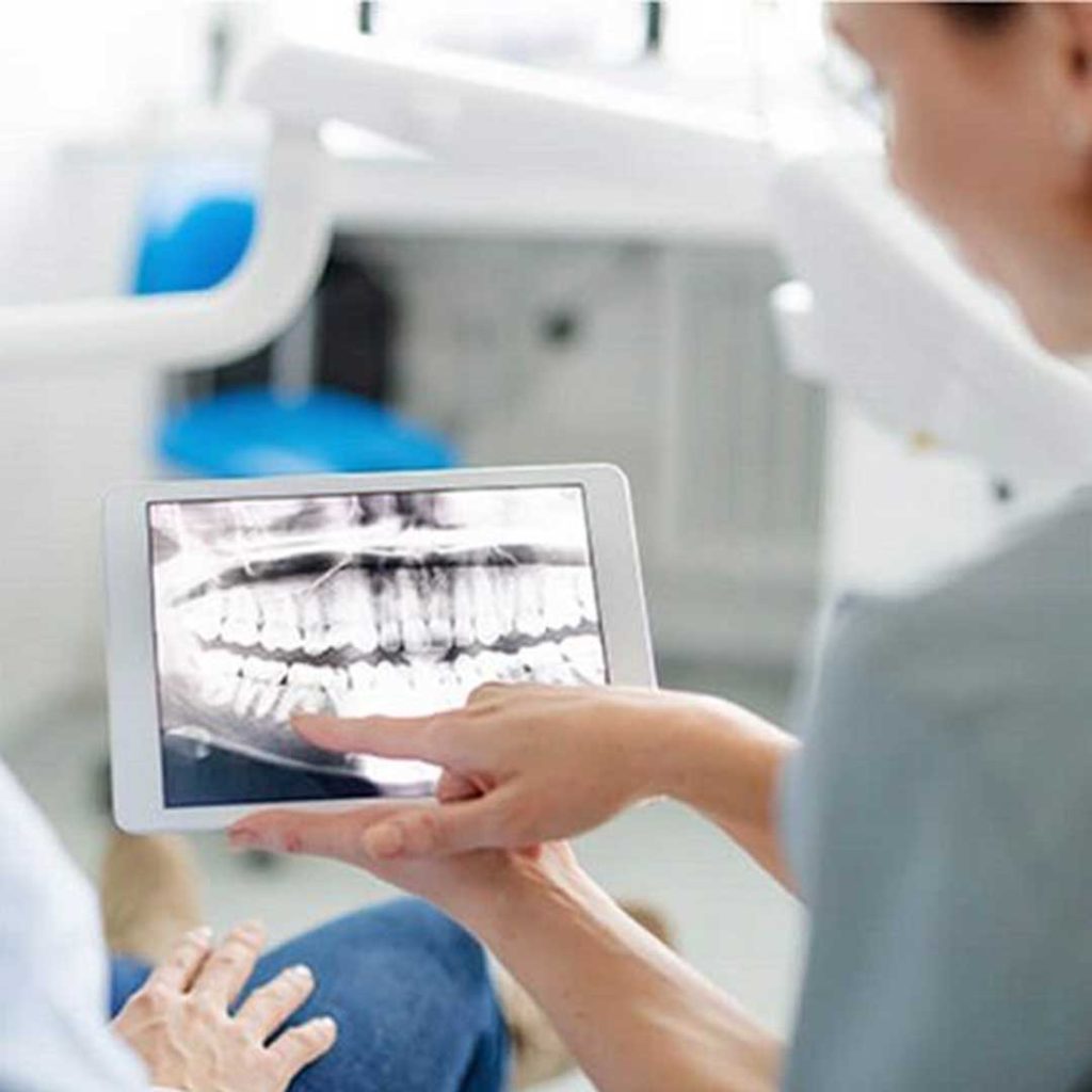 A highly recommended San Diego oral surgeon providing a consultation for wisdom teeth removal and dental implants using 3D technology.