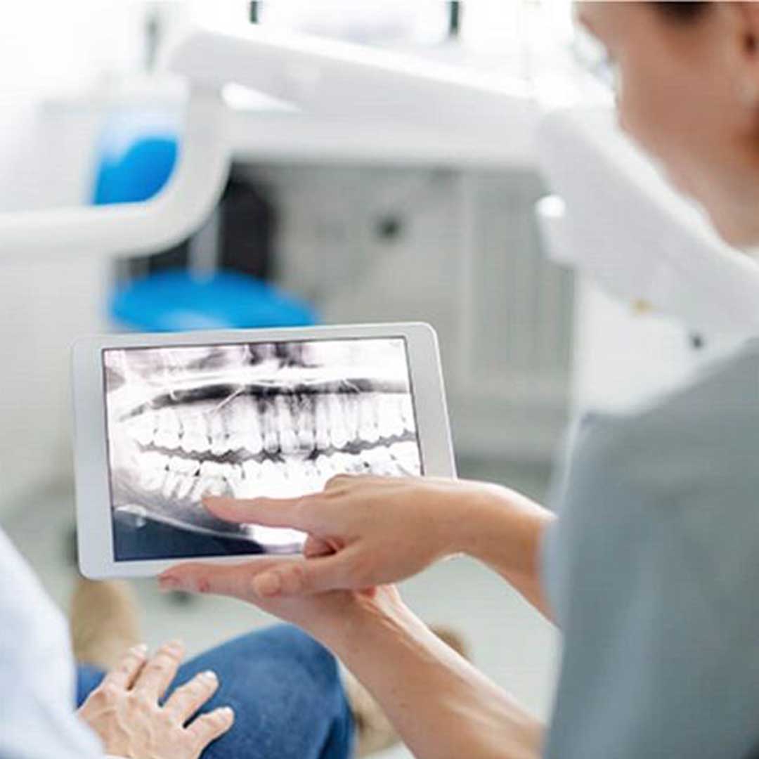 A highly recommended San Diego oral surgeon providing a consultation for wisdom teeth removal and dental implants using 3D technology.