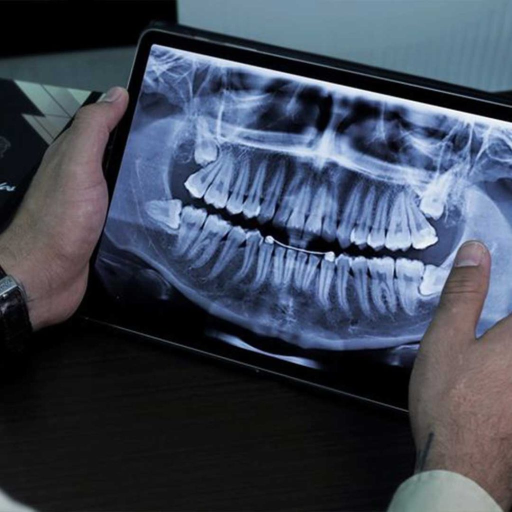 A board-certified surgeon at Elevated Oral Surgery using 3D CBCT technology to plan a complex maxillofacial procedure in San Diego.
