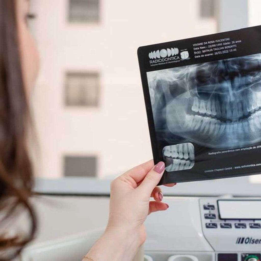A board-certified surgeon at Elevated Oral Surgery using 3D CBCT imaging to plan a safe wisdom tooth extraction in San Diego.